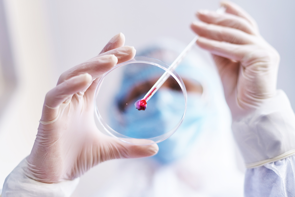 Hypodiploid ALL (“HALL”)research image